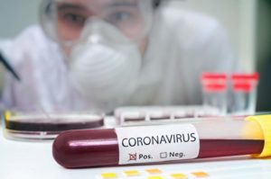 coronavirus-italia-contagio-treviso-studente