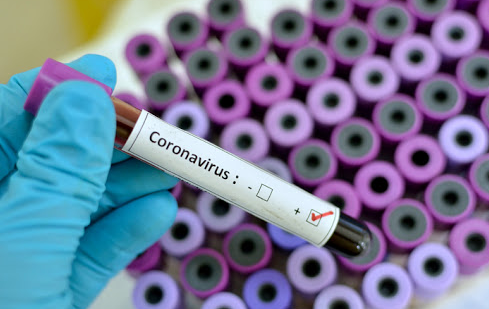 coronavirus-situazione-molise