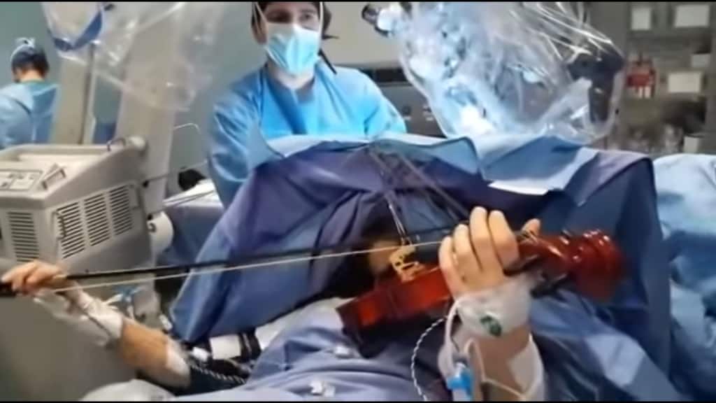 suona-violino-operazione-tumore-cervello