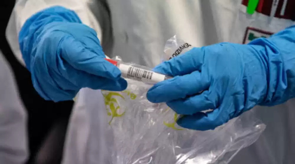 contagi-coronavirus-irpinia-15-marzo