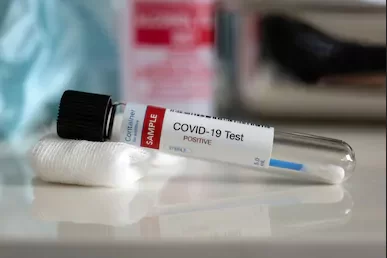 coronavirus-situazione-sannio