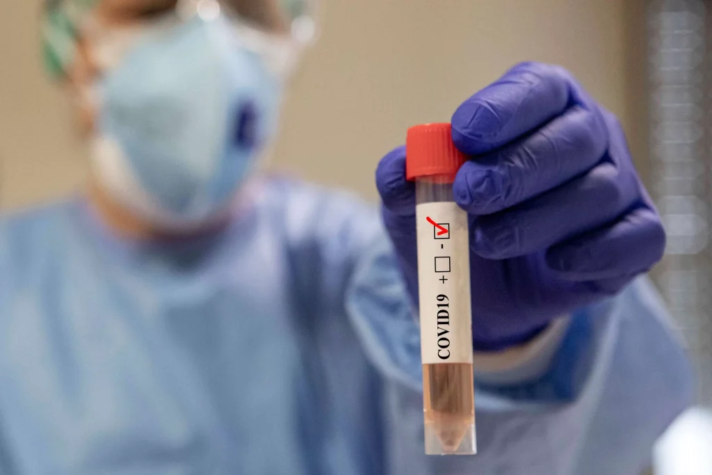 coronavirus negativo
