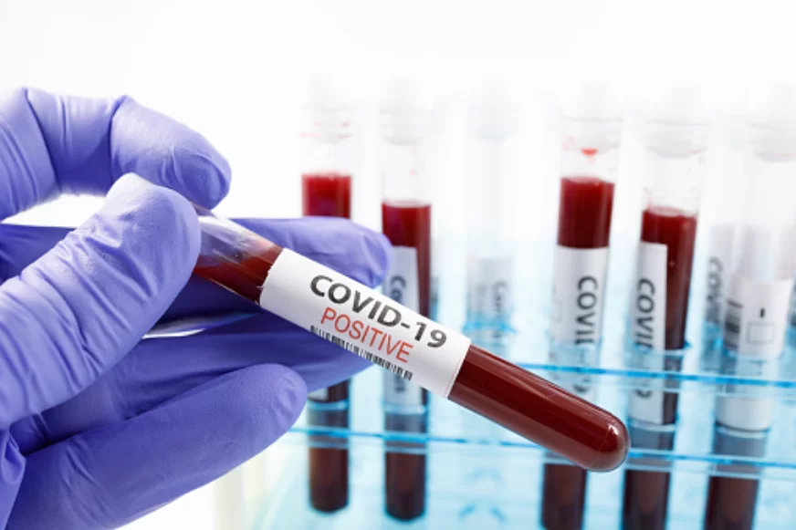 focolaio-coronavirus-campo-rom-scampia-ultime-notizie