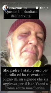 https://www.occhionotizie.it/padre-cantante-sirya-pugni-uomo-mascherina/
