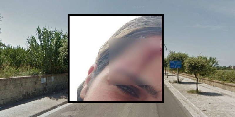 villaricca qualiano ragazza aggredita