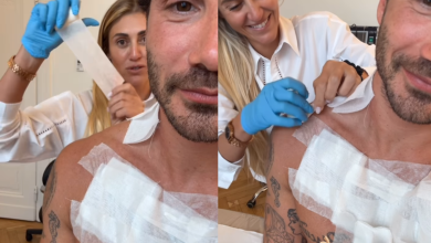 Stefano De Martino rimuove tatuaggi