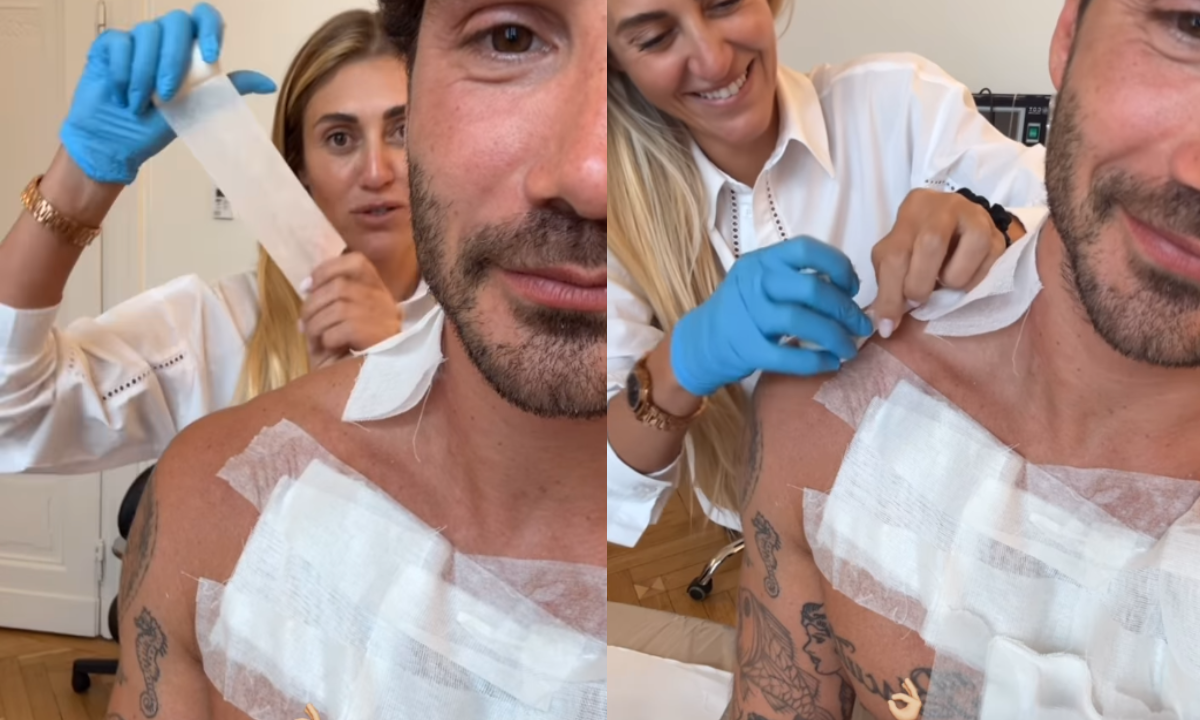 Stefano De Martino rimuove tatuaggi