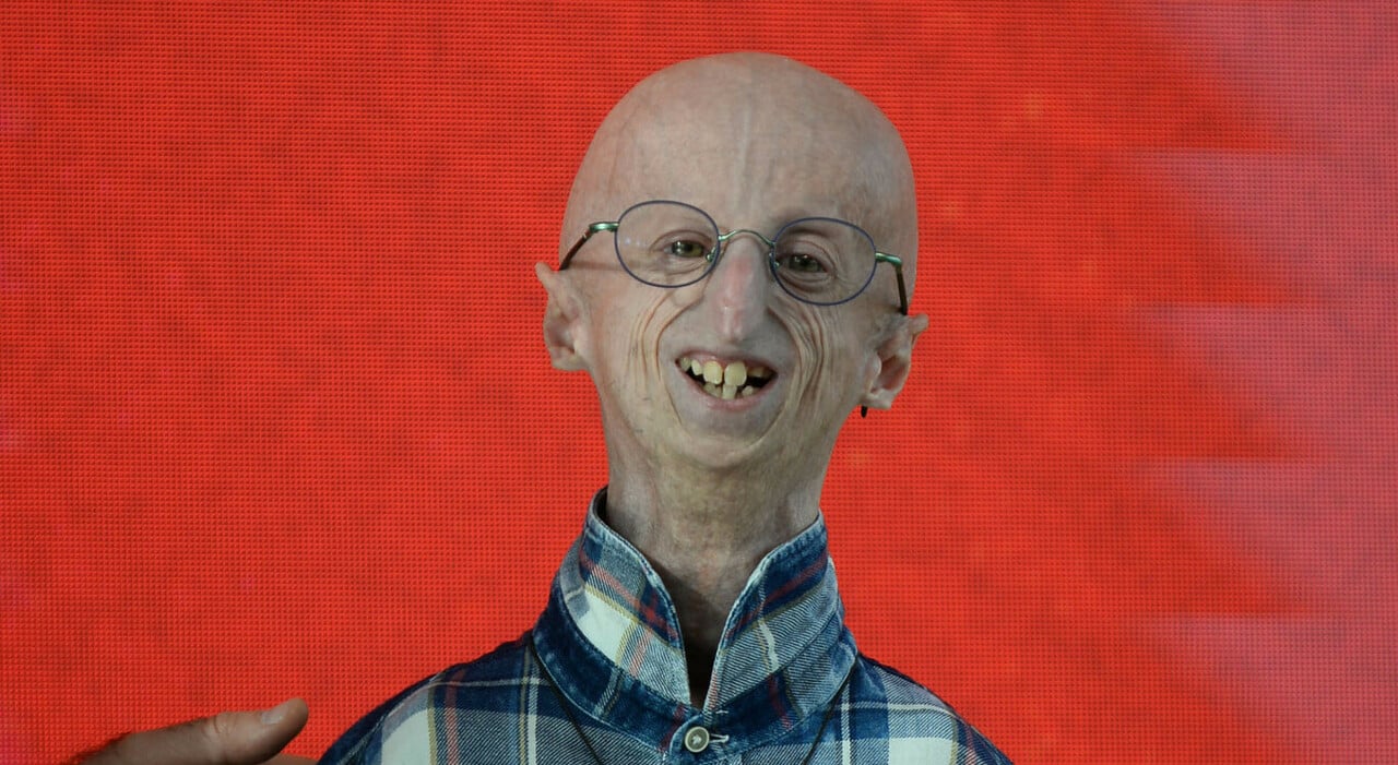 morto Sammy Basso simbolo lotta contro progeria